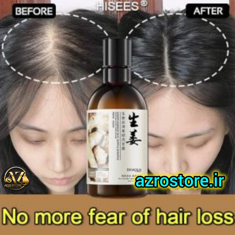 شامپو زنجفیل